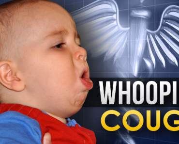 State warns parents about whooping cough WHOOPING COUGH