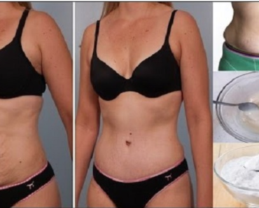 5 Ways Baking Soda Can Help You Lose Arm, Thigh, Belly, And Back Fat